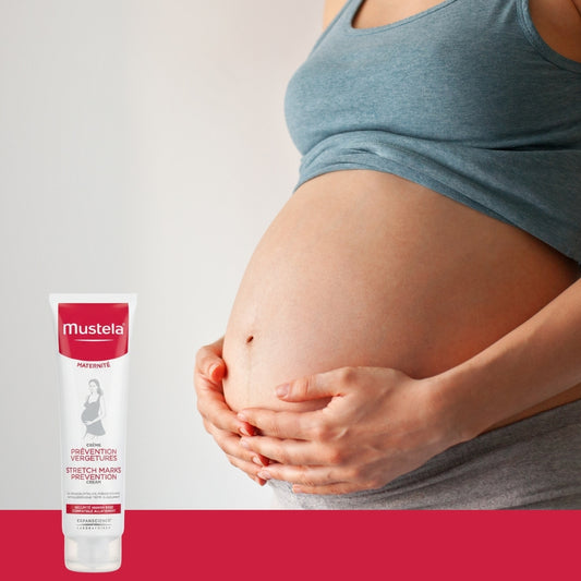 Mustela - Crema preventiva para estrías (150 ml)