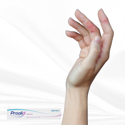 Proalid Tacrolimus 0,03% - Ungüento para dermatitis atópica (15 g)