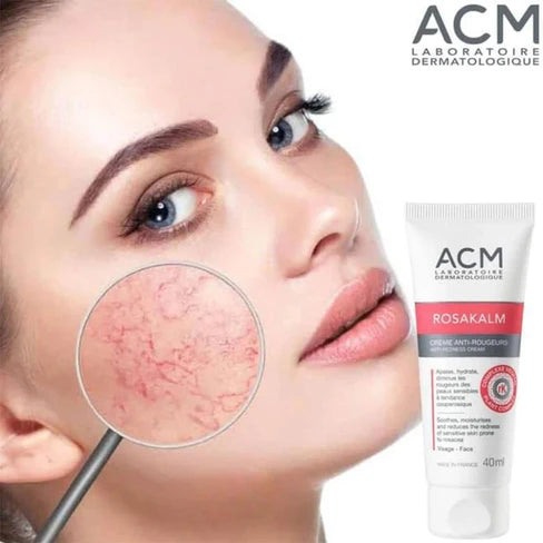 ACM Rosakalm – Crema Anti-Rojeces (40 ml)